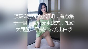 刚拔完火罐的老婆